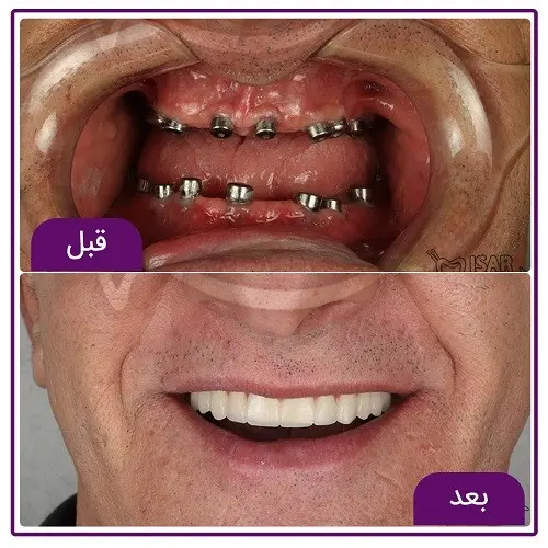 کلینیک دندانپزشکی ایثار (4)