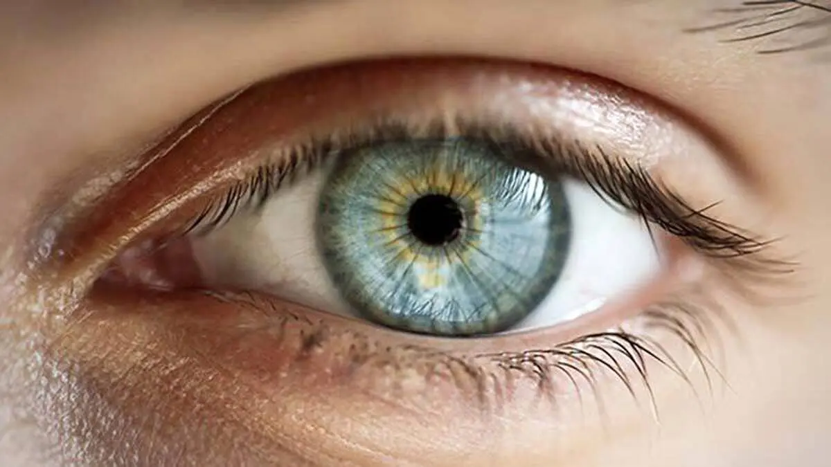 (ویدئو) راه حل درمان کاربردی چشم آستیگماتیسم