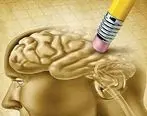 زوال عقل چیست ؟ | علائم و درمان زوال عقل