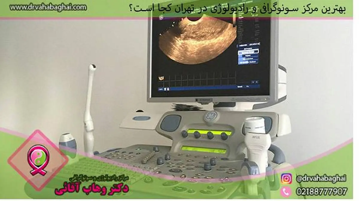 بهترین مرکز سونوگرافی و رادیولوژی در تهران کجا است؟