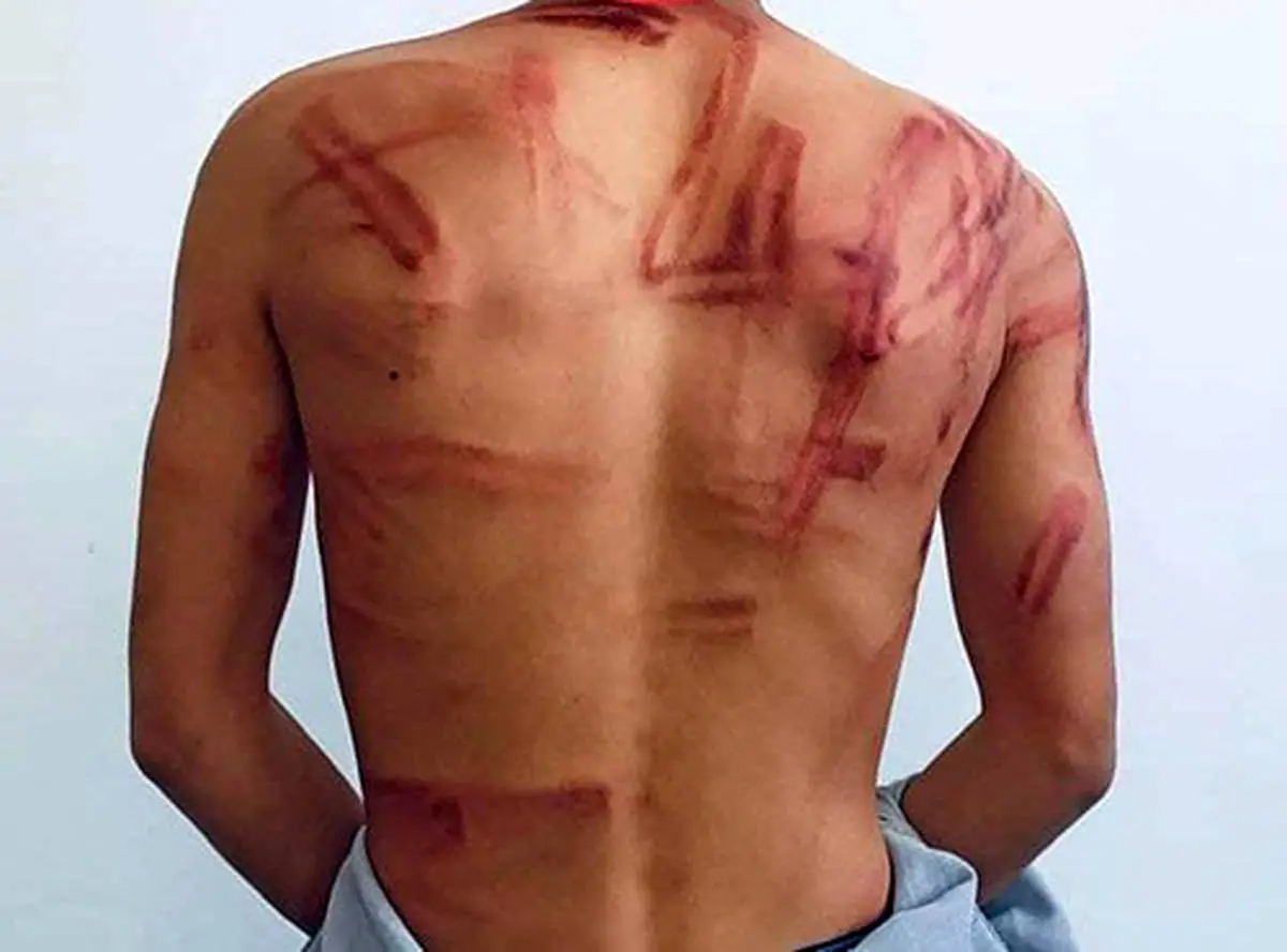 شکنجه های عکاس ایرانی توسط طالبان+ عکس