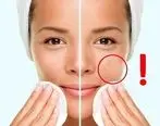 با رعایت این چند نکته سلامتی پوست صورتتان را تضمبن می کنید 