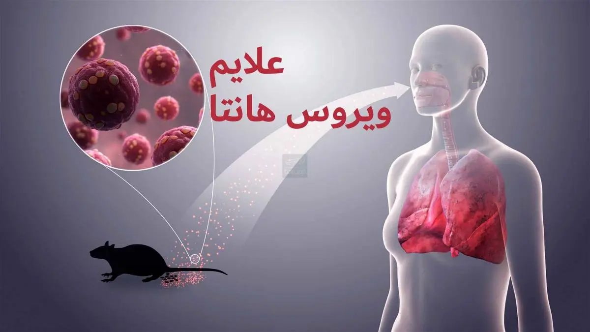 هانتا | همه چیز در مورد ویروس هانتا + علایم ویروس