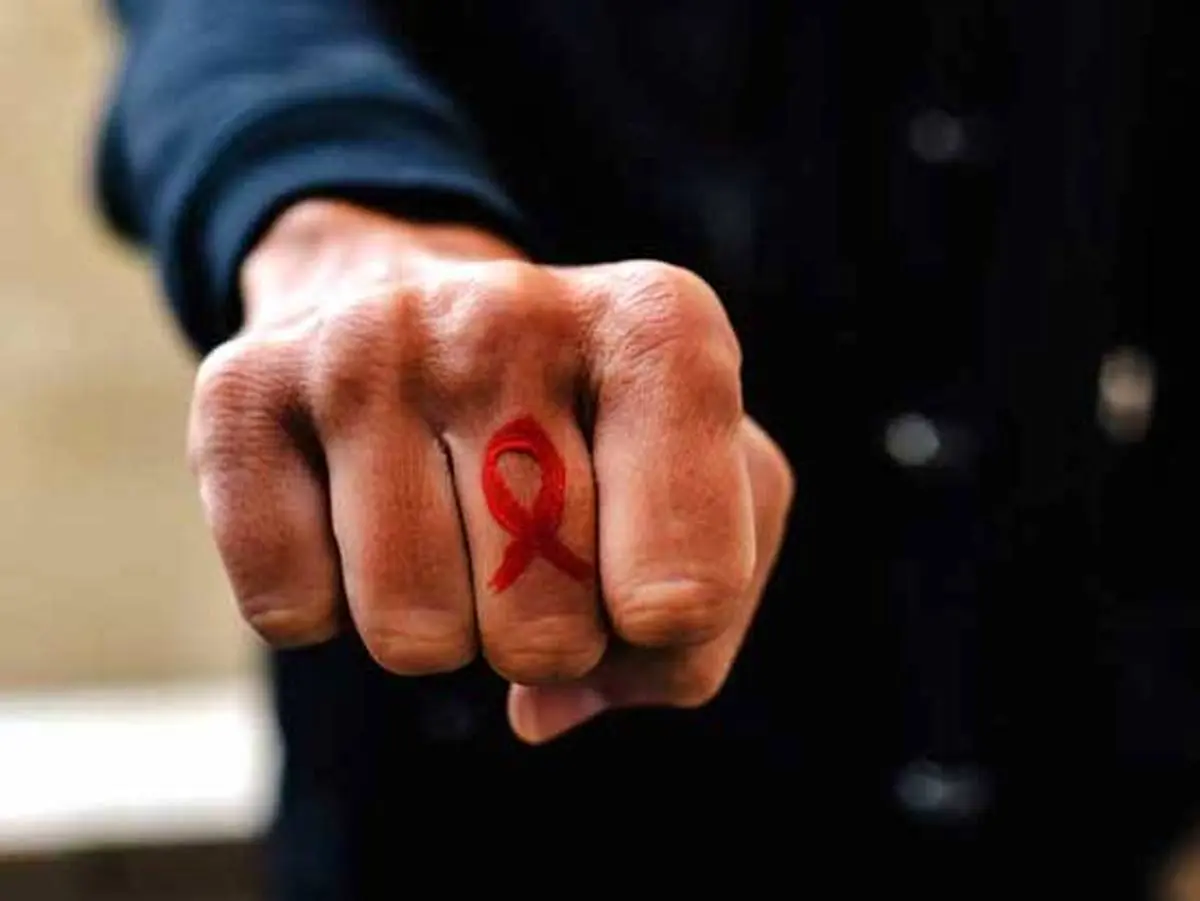 ایدز چیست؟ + علائم اصلی HIV و راه های درمان