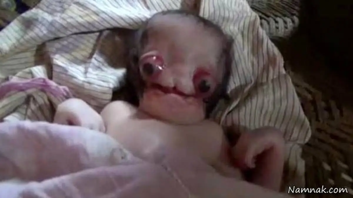 فیلم +18 از ترسناک ترین و عجیب ترین نوزاد دنیا | فیلم دیده نشده