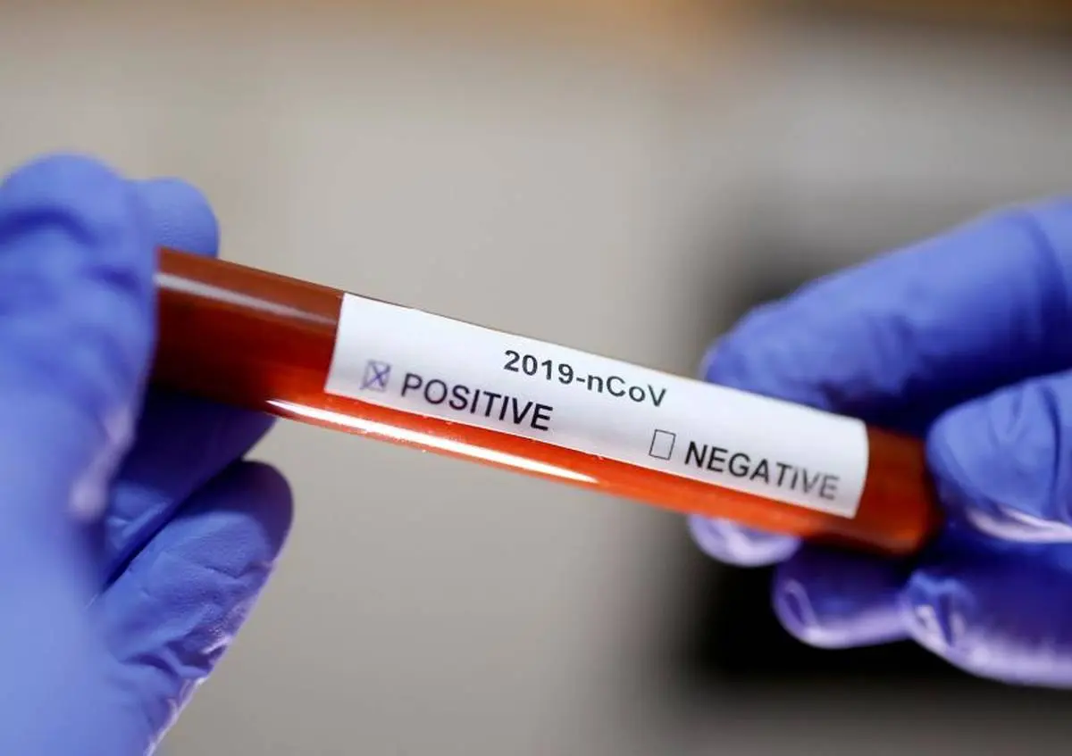 ۴ فرد مبتلا به ویروس کرونا در گلپایگان شناسایی شدند

