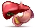 علائم پر شدن کیسه صفرا و راه‌های درمان آن: آنچه باید بدانید