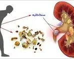  چگونه متوجه شویم که سنگ کلیه داریم؟ علائم، تشخیص و درمان

