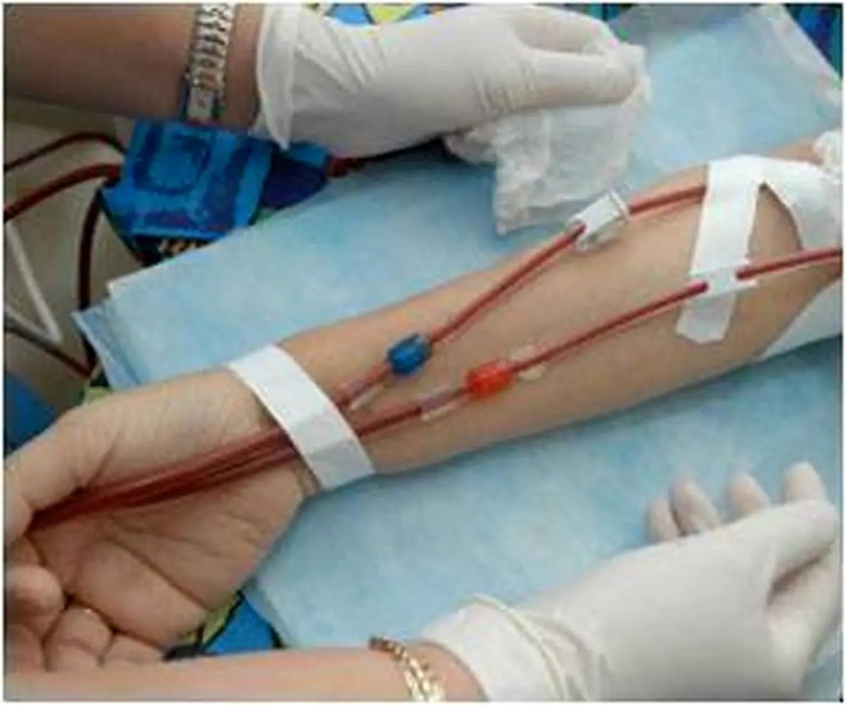 در بخش دیالیز بیمارستان سینای خوزستان چه گذشت؟