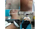 کتک کاری بیمار با مسئول بیمارستان در قزوین حاشیه ساز شد + عکس