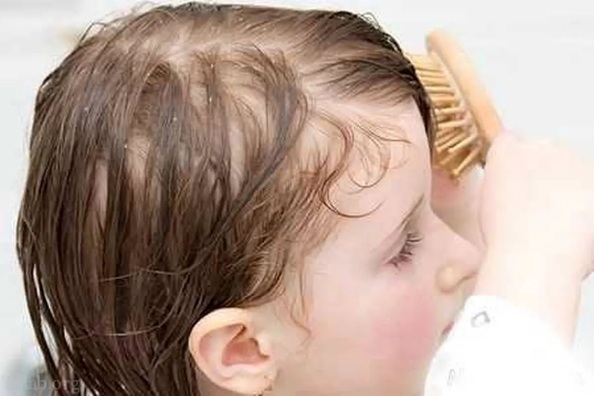 آیا میدانید علت و درمان ریزش مو در کودکان چیست ؟