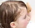 آیا میدانید علت و درمان ریزش مو در کودکان چیست ؟