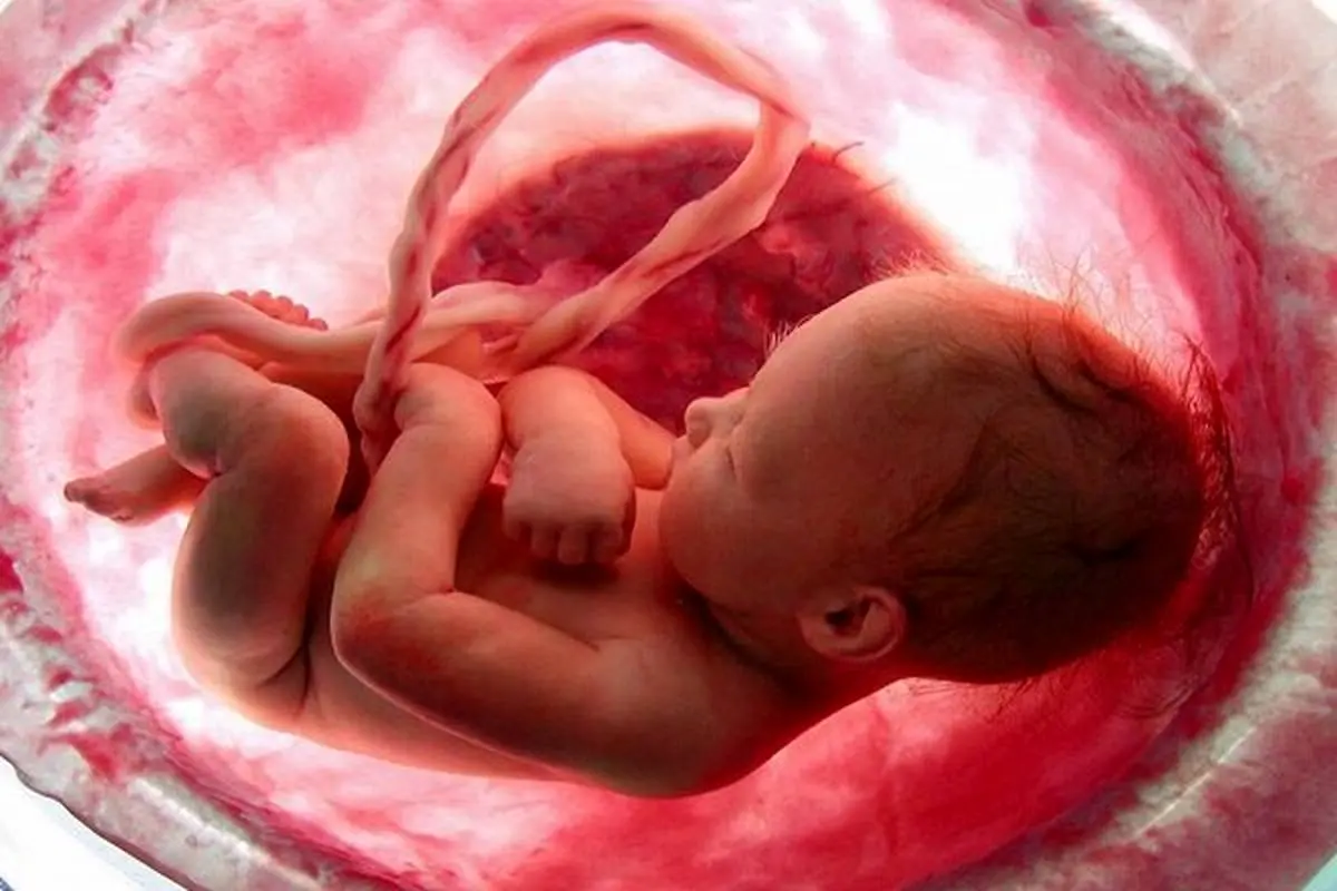 پزشکی قانونی :صدور بیش از ۵۰۰ مجوز سقط جنین درمانی در ۶ ماهه نخست امسال