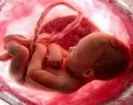 پزشکی قانونی :صدور بیش از ۵۰۰ مجوز سقط جنین درمانی در ۶ ماهه نخست امسال
