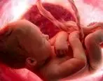 دیه سقط جنین چقدر است؟