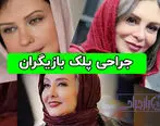 بازیگرانی که جراحی زیبایی کرده اند| از بهاره رهنما تا نیکی کریمی+عکس