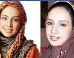 چهره شبنم قلی خانی قبل و بعد از عمل زیبایی | عکس همسر شبنم قلی خانی
