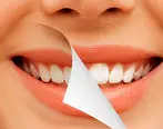 دندان هایتان را با این ادویه سفید کنید
