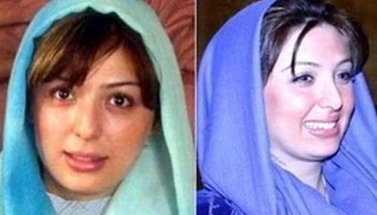چهره نیوشا ضیغمی قبل و بعد از عمل زیبایی | بیوگرافی نیوشا ضیغمی 
