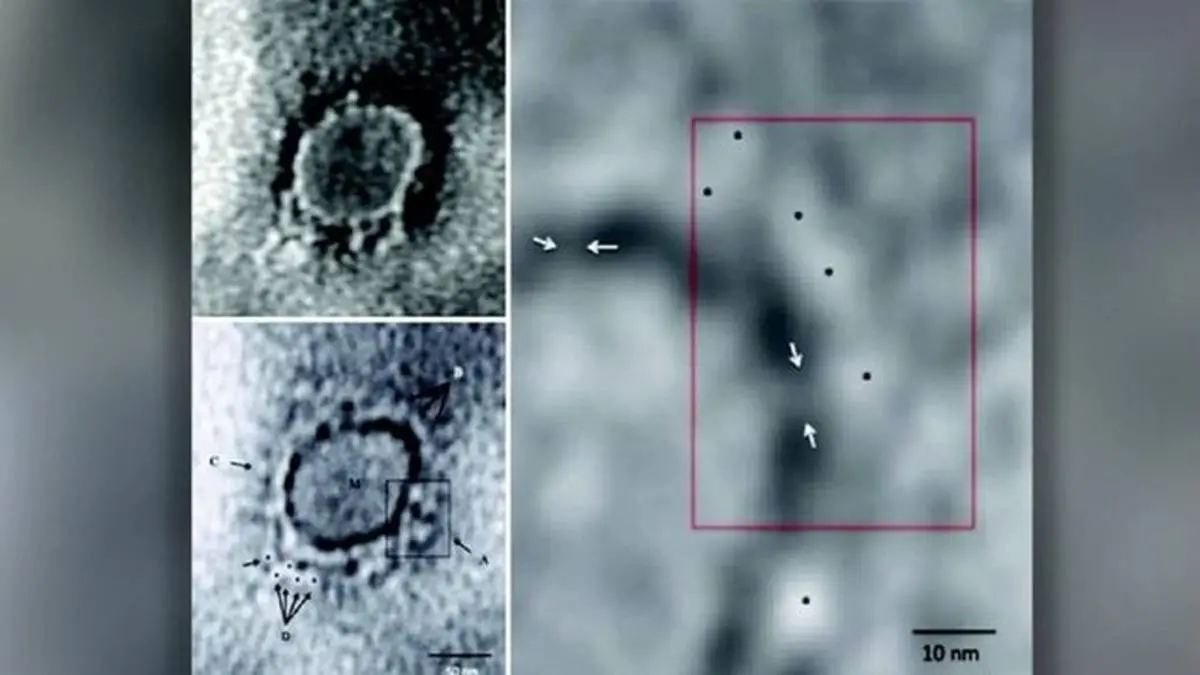 تصویر میکروسکوپی "کرونا" را منتشر شد