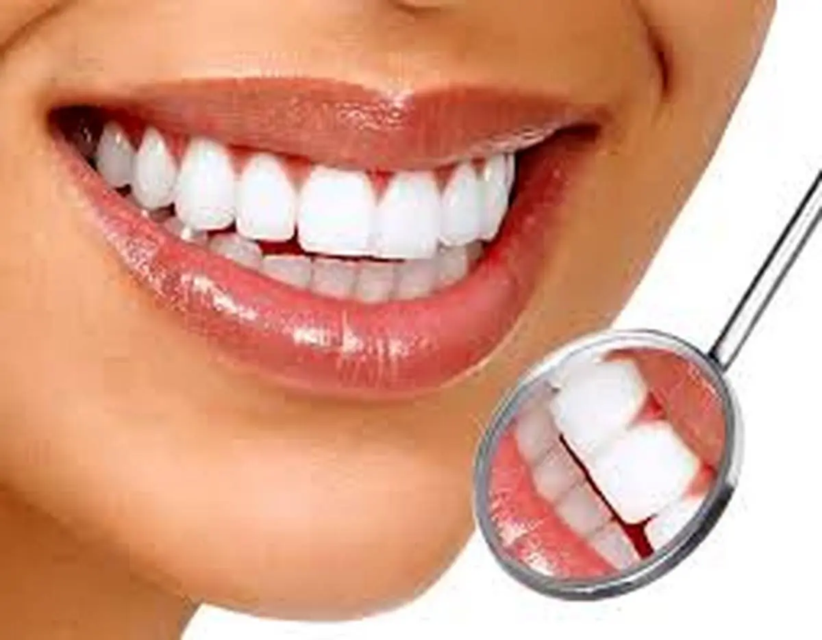 سفید کردن دندان در خانه با روشی ساده | دیگه نگران زردی دندان هات نباش