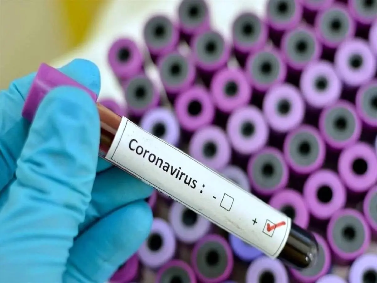 سه مورد جدید ابتلای به ویروس کرونا تایید شد