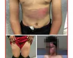 ضرب و شتم شدید پسر 12 ساله توسط پدر مشهدی + تصاویر دردناک 