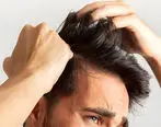 مردان چگونه از ریزش موهایشان جلوگیری کنند 