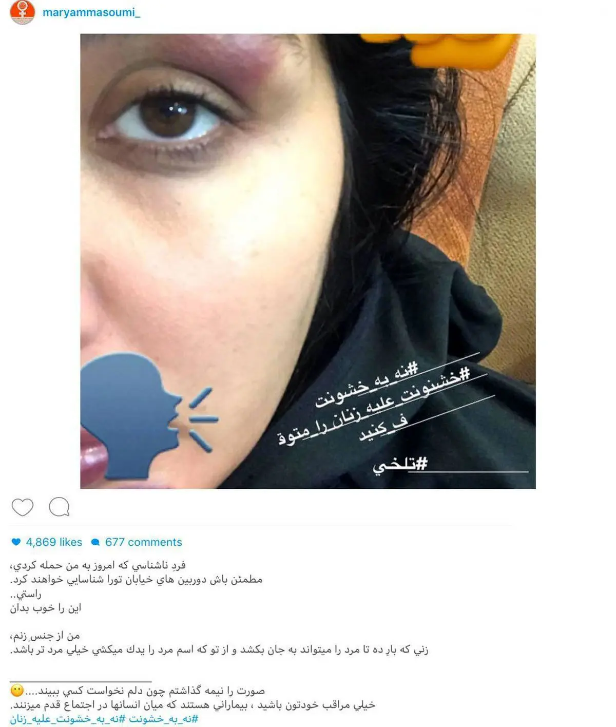 حمله فیزیکی افراد ناشناس به بازیگر زن ایرانی!