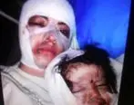 جزئیات اسیدپاشی روی صورت عمه و کودک ۲ ساله + عکس