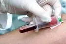 ویدیو / خیلی راحت تو خونه آزمایش خون رو تفسیر کن