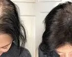 4 راهکار برای پرپشت شدن مو سر | موهای نازک خود را درمان کنید