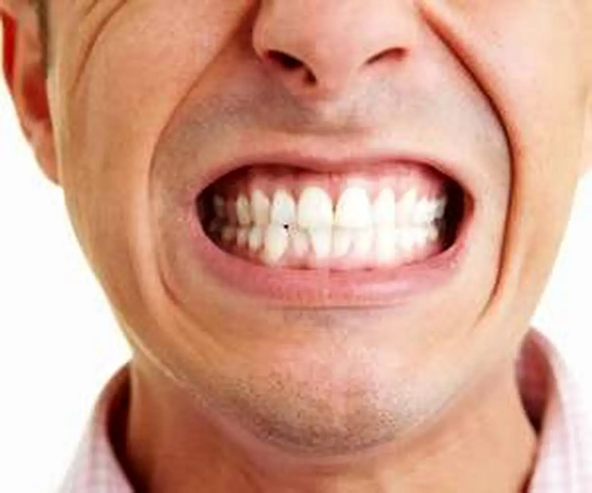 دندان قروچه چه بلایی می تواند  بر سر دندانهای شما می آورد؟