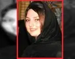 مرگ دردناک دختر جوان بوشهری در عمل زیبایی + عکس