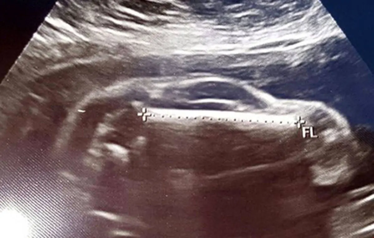 زنی که یک خودروی اسپرت باردار است+عکس