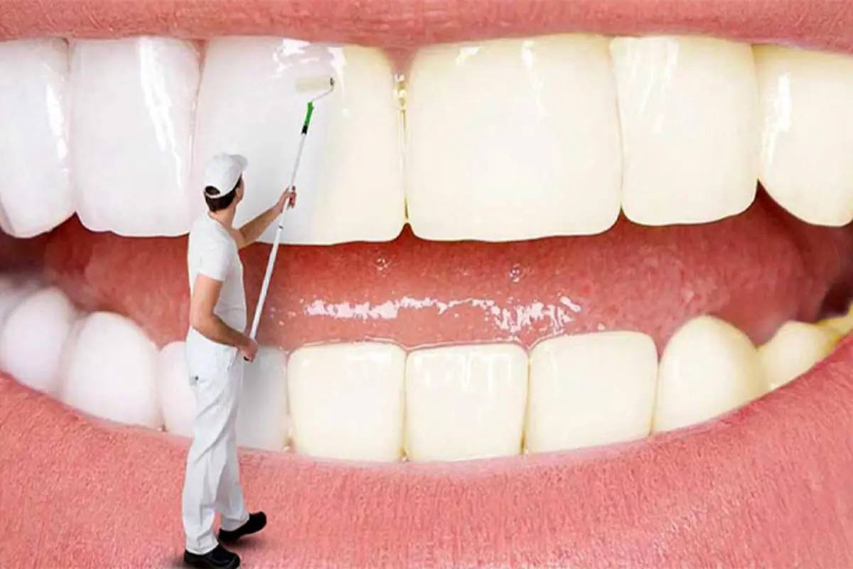 سفید کردن دندان در خانه با دو روش ساده | دیگه نگران زردی دندانت نباش