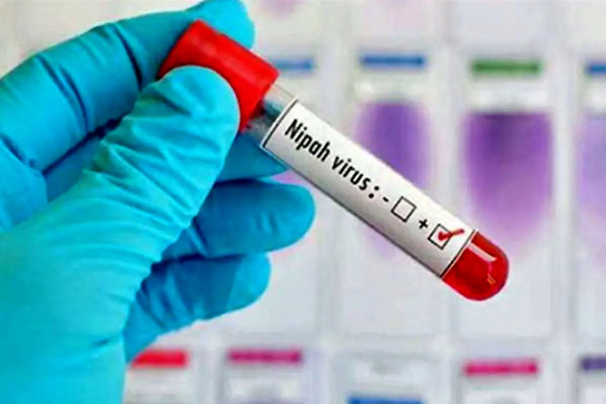 ویروس کشنده نیپا چیست؟ + علایم و درمان