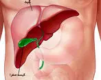 کبدتان با این علائم چرب  هست