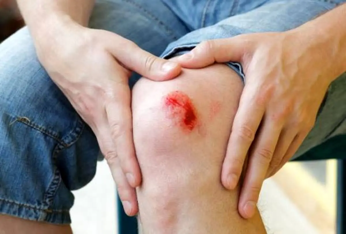 ۱۵ روش تضمینی خانگی که زخم هایتان را درمان می کند