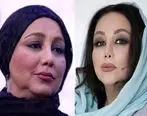 چهره بهنوش بختیاری قبل و بعد از عمل زیبایی | بیوگرافی بهنوش بختیاری