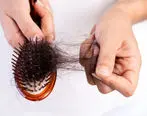 مصرف زیاد این ویتامین ریزش مو را تشدید می‌کند | ریزش موی طبیعی چقدر است