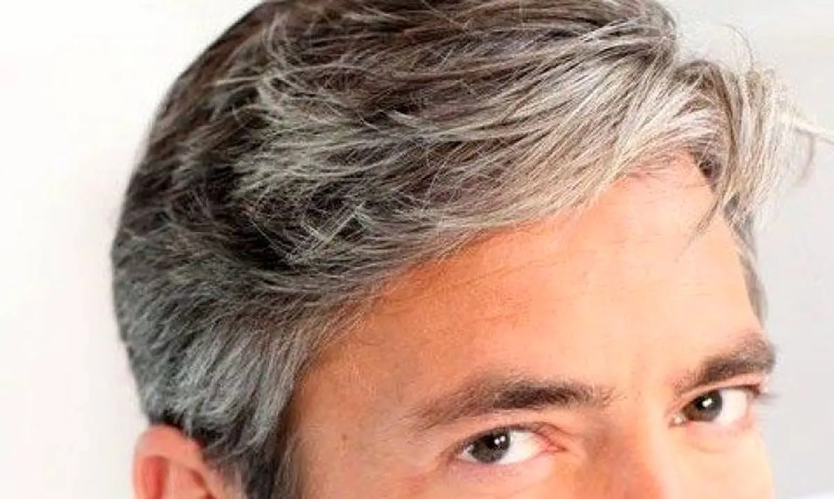 علت پیری زودرس مو چیست ؟ 
