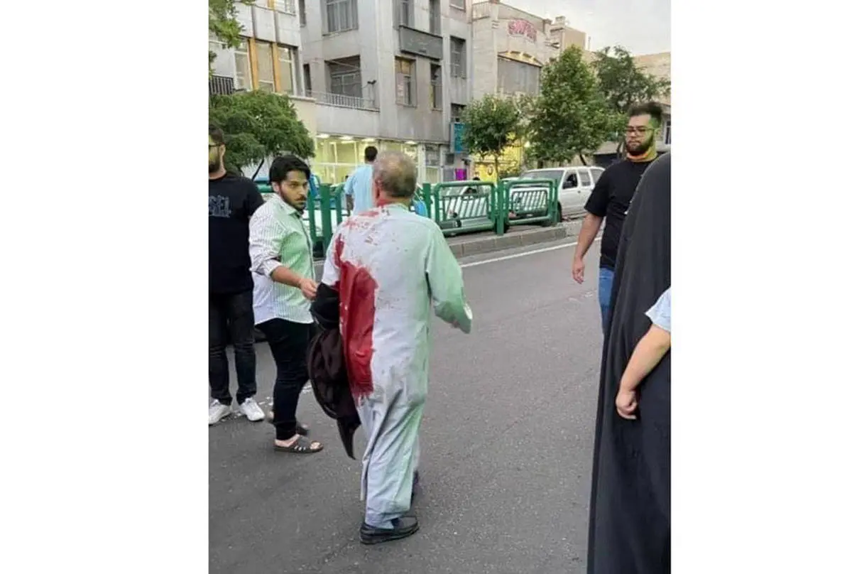 روحانی مسجد با تیغ موکت بری مورد حمله اوباش قرار گرفت