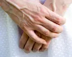 نحوه درمان پیری پوست دست + عوامل 