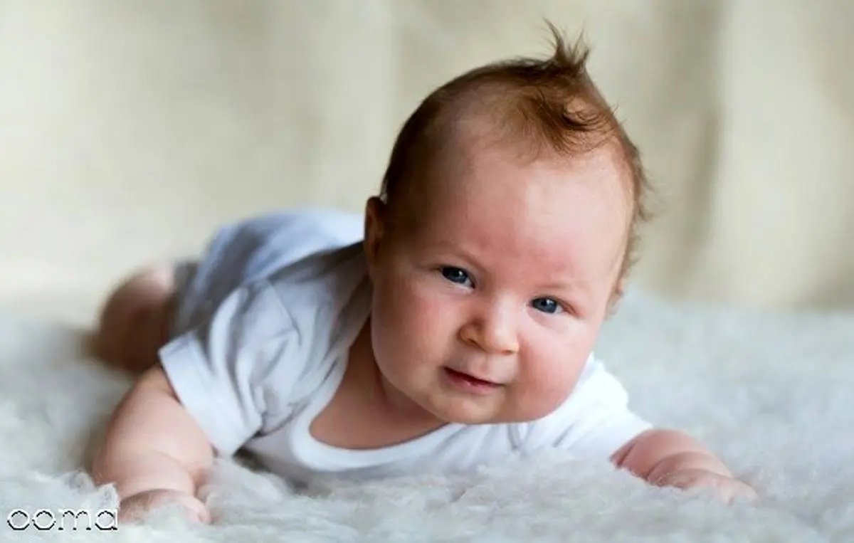 علت ریزش مو در نوزادان چیست؟