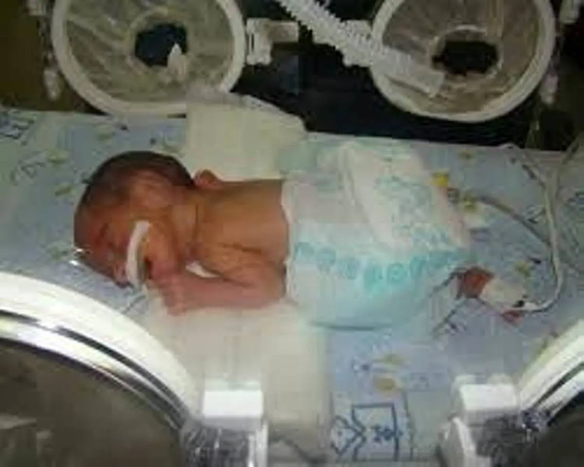 نجات جان نوزاد 900 گرمی در فسا