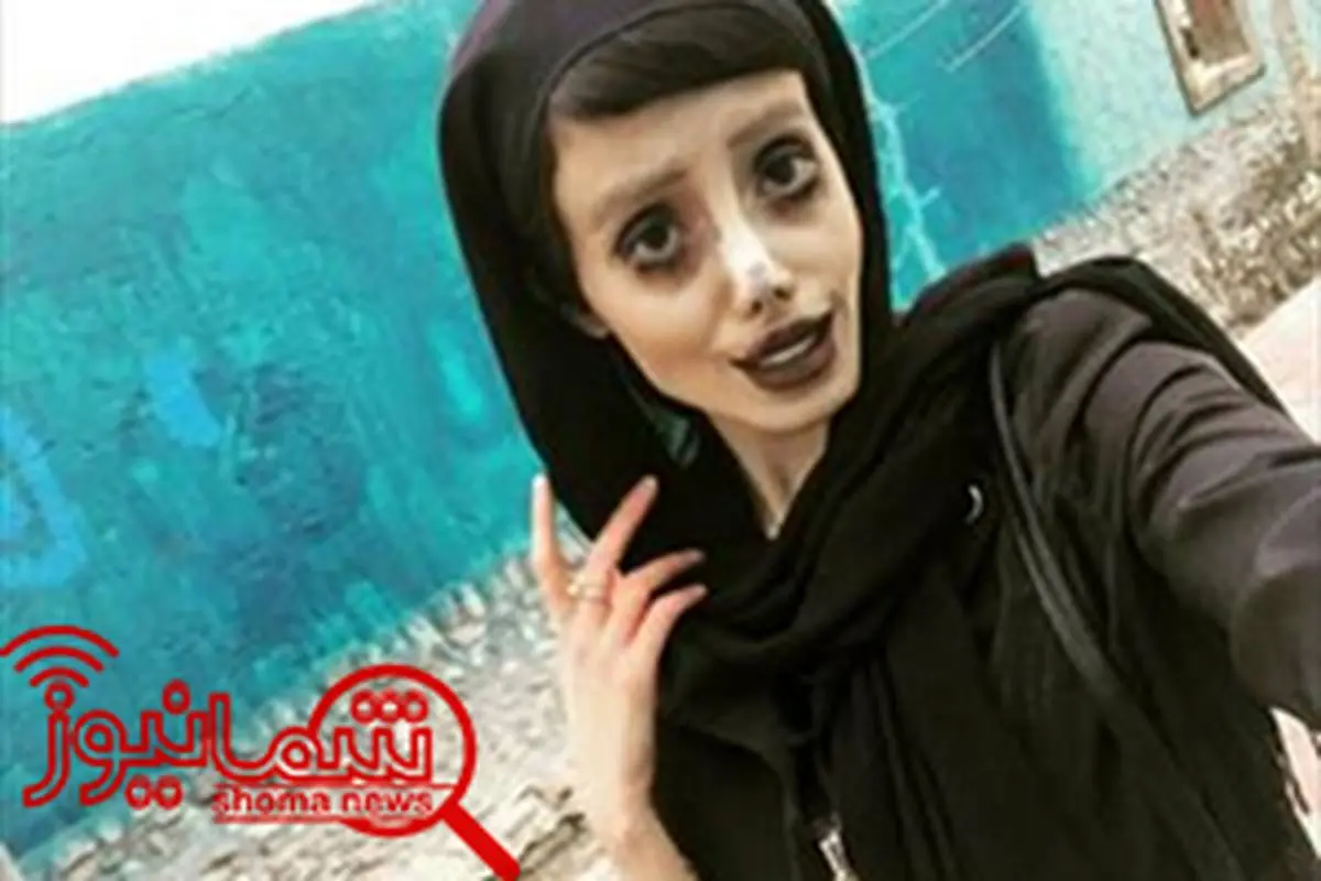 دختر ایرانی پس از 50 جراحی پلاستیک، عروس مرده شد! + تصاویر