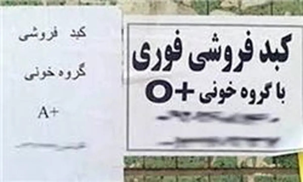 ماجرای فروش کبد ۵۰۰ میلیونی در تهران