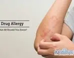 آنچه از علائم شایع آلرژی دارویی نمی دانید!