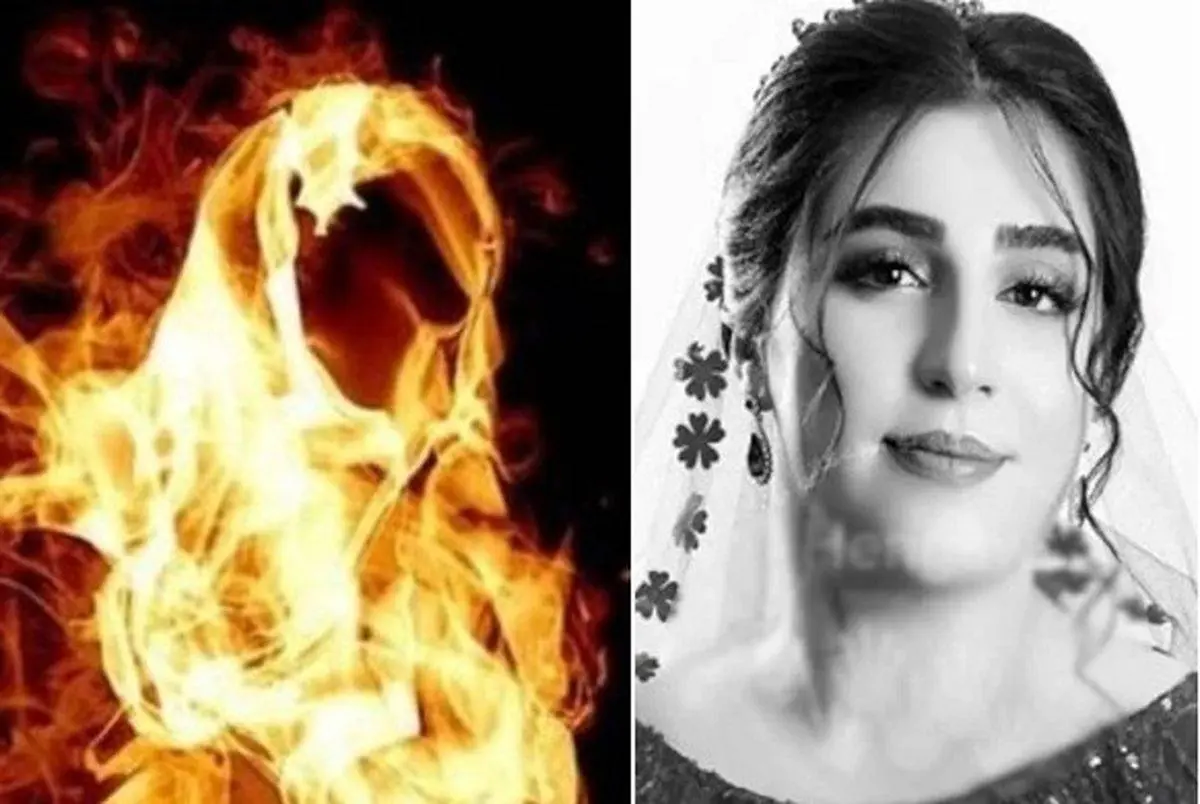 دختر جوان سقزی توسط نامزدش سوزانده شد + عکس جگرسوز